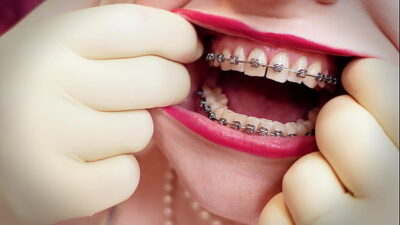 ASMR video: MILF wearing double layer medical gloves and showing braces. 4k video fetish sounds